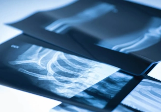 рентген снимки у врача травматолога на столе